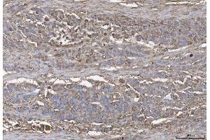 IHC analysis of ANXA4 using anti-ANXA4 antibody (ABIN5518805). (Annexin IV antibody  (Middle Region))