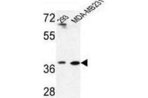 Western Blotting (WB) image for anti-Methionine Adenosyltransferase II, beta (MAT2B) antibody (ABIN3004219)