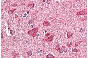 Human Brain, Cortex (formalin-fixed, paraffin-embedded) stained with PITPNM3 antibody ABIN337021 at 5 ug/ml followed by biotinylated anti-goat IgG secondary antibody ABIN481715, alkaline phosphatase-streptavidin and chromogen. (NIR1 antibody  (AA 962-974))