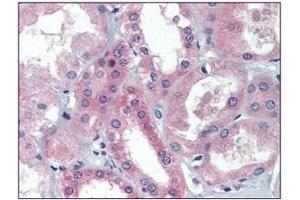 Immunohistochemistry (IHC) image for anti-BRCA1/BRCA2-Containing Complex, Subunit 3 (BRCC3) (AA 1-316), (N-Term) antibody (ABIN400864) (BRCC3 antibody  (N-Term))