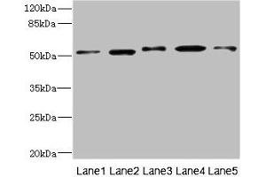 Western blot All lanes: NFKBIE antibody at 4. (NFKBIE antibody  (AA 140-280))