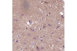 ABIN6266852 at 1/100 staining human brain tissue sections by IHC-P.
