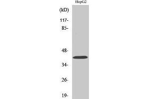 Western Blotting (WB) image for anti-Ribosomal Modification Protein RimK-Like Family Member B (RIMKLB) (Internal Region) antibody (ABIN3184591) (RIMKLB antibody  (Internal Region))