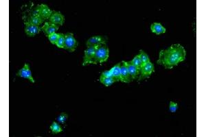 Immunofluorescent analysis of HepG2 cells using ABIN7173992 at dilution of 1:100 and Alexa Fluor 488-congugated AffiniPure Goat Anti-Rabbit IgG(H+L) (Tat (AA 25-111) antibody)
