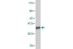 Western Blot detection against Immunogen (37. (NXNL1 antibody  (AA 81-190))