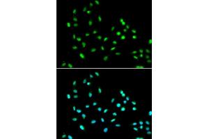 Immunofluorescence analysis of  cells using SM antibody (ABIN6131360, ABIN6148103, ABIN6148105 and ABIN6221551). (SMARCAD1 antibody  (AA 1-300))