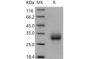 Western Blotting (WB) image for Bone Morphogenetic Protein Receptor 1A (BMPR1A) (Active) protein (His tag) (ABIN7320449) (BMPR1A Protein (His tag))