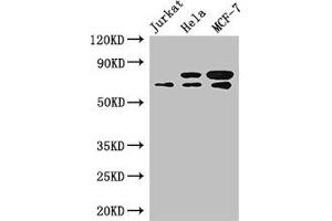 Western Blot Positive WB detected in: Jurkat whole cell lysate, Hela whole cell lysate, MCF-7 whole cell lysate All lanes: INTS9 antibody at 3. (INTS9 antibody  (AA 368-658))