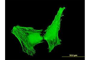 Immunofluorescence of monoclonal antibody to ACTR1B on HeLa cell. (ACTR1B antibody  (AA 191-286))