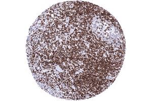 Tonsil Strong CD5 positivity of T lymphocytes interfollicular and in germinal centres (Recombinant CD5 antibody  (AA 32-372))
