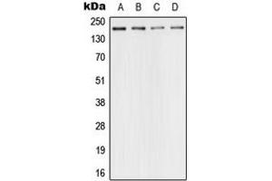 Western blot analysis of 53BP1 expression in HeLa (A), SP2/0 (B), PC12 (C), rat kidney (D) whole cell lysates. (TP53BP1 antibody  (N-Term))