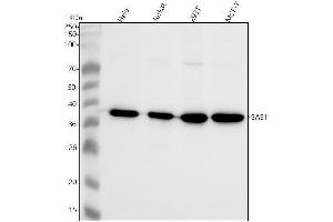 Western blot analysis of SAE1 using anti-SAE1 antibody (ABIN7606234).