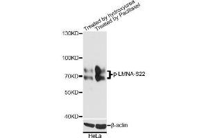 Western blot analysis of extracts of HeLa cells,using Phospho-LMNA-S22 antibody. (Lamin A/C antibody  (pSer22))