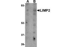 Western Blotting (WB) image for anti-Scavenger Receptor Class B, Member 2 (SCARB2) (C-Term) antibody (ABIN1030483) (SCARB2 antibody  (C-Term))