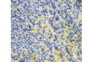 #VALUE! (IL-6 antibody  (AA 25-211))