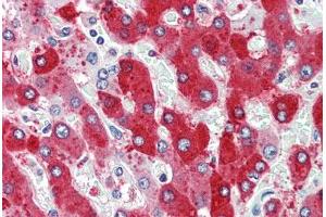 Human, Liver: Formalin-Fixed Paraffin-Embedded (FFPE) (CDCP1 antibody  (N-Term))
