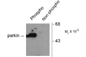 Western blots of HEK293 cells transfected with Parkin WT (Phospho) and Parkin S101 mutant (non-phospho) showing the phospho-specific immunolabeling of the ~ 52 k parkin protein. (Parkin antibody  (pSer101))