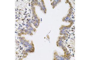 Immunohistochemistry of paraffin-embedded human lung using SPR antibody. (SPR antibody)