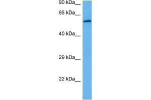 Western Blotting (WB) image for anti-Glutamate Dehydrogenase 1 (GLUD1) (N-Term) antibody (ABIN2782330)
