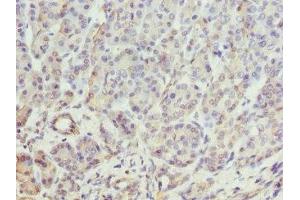 Immunohistochemistry of paraffin-embedded human pancreatic tissue using ABIN7145897 at dilution of 1:100 (BTNL2 antibody  (AA 246-455))
