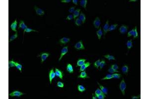 Immunofluorescent analysis of A375 cells using ABIN7155613 at dilution of 1:100 and Alexa Fluor 488-congugated AffiniPure Goat Anti-Rabbit IgG(H+L) (HLA-DRB1 antibody  (AA 30-266))