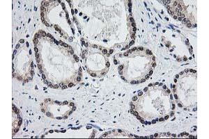 Image no. 3 for anti-Aminoacylase 1 (ACY1) antibody (ABIN1496454) (Aminoacylase 1 antibody)