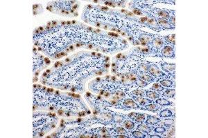 Anti-Hsp105 antibody, IHC(P) IHC(P): Rat Intestine Tissue (HSPH1 antibody  (C-Term))