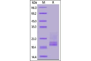 Human CD3E&CD3D Heterodimer Protein, His Tag&Tag Free on  under reducing (R) condition.