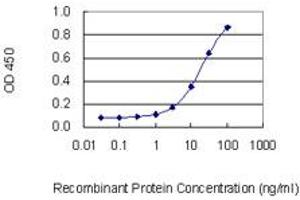 Detection limit for recombinant GST tagged ASB2 is 1 ng/ml as a capture antibody. (ASB2 antibody  (AA 1-587))