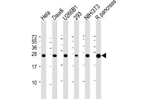 All lanes : Anti-RPL10 Antibody (N-term) at 1:2000 dilution Lane 1: Hela whole cell lysate Lane 2: Daudi whole cell lysate Lane 3: U266B1 whole cell lysate Lane 4: 293 whole cell lysate Lane 5: NIH/3T3 whole cell lysate Lane 6: Rat pancreas lysate Lysates/proteins at 20 μg per lane. (RPL10 antibody  (N-Term))