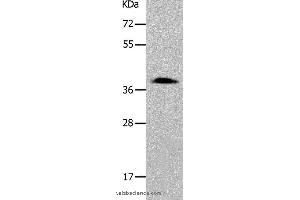 Western blot analysis of 293T cell, using PARD6A Polyclonal Antibody at dilution of 1:700 (PARD6A antibody)