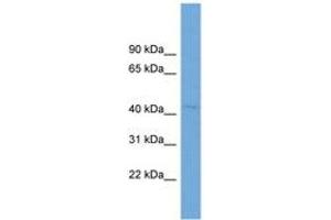 Image no. 1 for anti-Rab9 Effector Protein with Kelch Motifs (RABEPK) (AA 35-84) antibody (ABIN6744934) (RABEPK antibody  (AA 35-84))