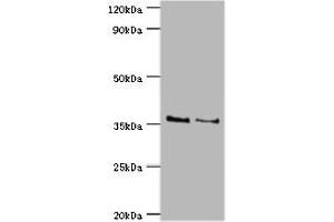 Western blot All lanes: HOXA1 antibody at 2 μg/mL Lane 1: NIH/3T3 whole cell lysate Lane 2: Hela whole cell lysate Secondary Goat polyclonal to rabbit IgG at 1/10000 dilution Predicted band size: 37, 15, 25 kDa Observed band size: 37 kDa