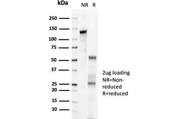 Rekombinanter CDKN1C Antikörper