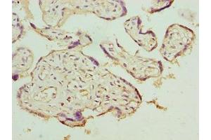 Immunohistochemistry of paraffin-embedded human placenta tissue using ABIN7158182 at dilution of 1:100 (LRRC42 antibody  (AA 201-428))
