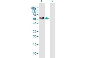 Western Blot analysis of NTNG1 expression in transfected 293T cell line by NTNG1 MaxPab polyclonal antibody. (Netrin G1 antibody  (AA 1-438))