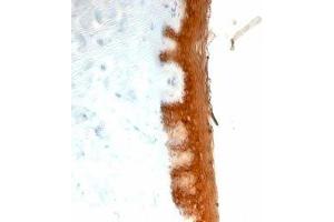 Formalin-fixed, paraffin-embedded human skin stained with Keratin 10 antibody (KRT10/844). (Keratin 10 antibody)