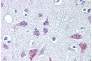Human Brain, Cortex (formalin-fixed, paraffin-embedded) stained with WNT8B antibody ABIN351424 at 10 ug/ml followed by biotinylated goat anti-rabbit IgG secondary antibody ABIN481713, alkaline phosphatase-streptavidin and chromogen. (WNT8B antibody  (Internal Region))