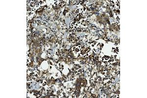 IHC analysis of Caspase-5/CASP5 using anti-Caspase-5/CASP5 antibody (ABIN7599992). (CASP5 antibody  (AA 137-434))