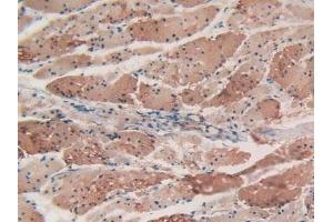 Detection of ACTa2 in Human Esophagus Tissue using Polyclonal Antibody to Actin Alpha 2, Smooth Muscle (ACTa2) (Smooth Muscle Actin antibody  (AA 167-377))