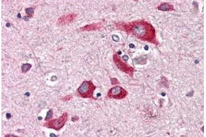 Immunohistochemical staining of human brain, cortex with ENTPD2 polyclonal antibody . (ENTPD2 antibody  (Internal Region))