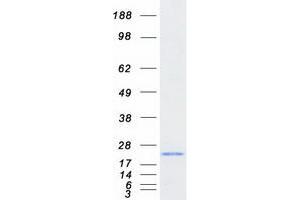 Western Blotting (WB) image for Methionine Sulfoxide Reductase B3 (MSRB3) (Transcript Variant 1) protein (Myc-DYKDDDDK Tag) (ABIN2726474)