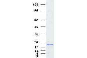 Validation with Western Blot (MSRB3 Protein (Transcript Variant 1) (Myc-DYKDDDDK Tag))