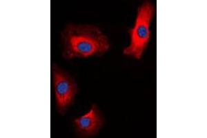 Immunofluorescent analysis of Amylin staining in HeLa cells. (Amylin/DAP antibody  (N-Term))