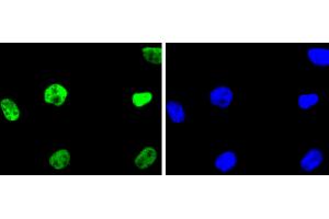 SHG-44 cells were fixed in paraformaldehyde, permeabilized with 0. (HDAC2 antibody)