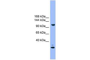 WB Suggested Anti-STARD8 Antibody Titration: 1. (STARD8 antibody  (N-Term))