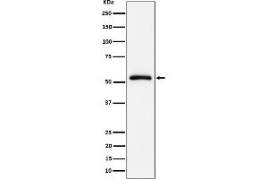 Western blot analysis of CAP1 expression in Raji cell lysate. (Recombinant CAP1 antibody)