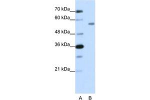 Western Blotting (WB) image for anti-Zinc Finger Protein 497 (ZNF497) antibody (ABIN2462019) (ZNF497 antibody)