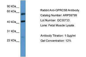 WB Suggested Anti-GPRC5B  Antibody Titration: 0. (GPRC5B antibody  (N-Term))