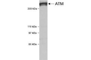 Western blot analysis of ATM in HeLa whole cell lysate using ATM polyclonal antibody . (ATM antibody  (C-Term))